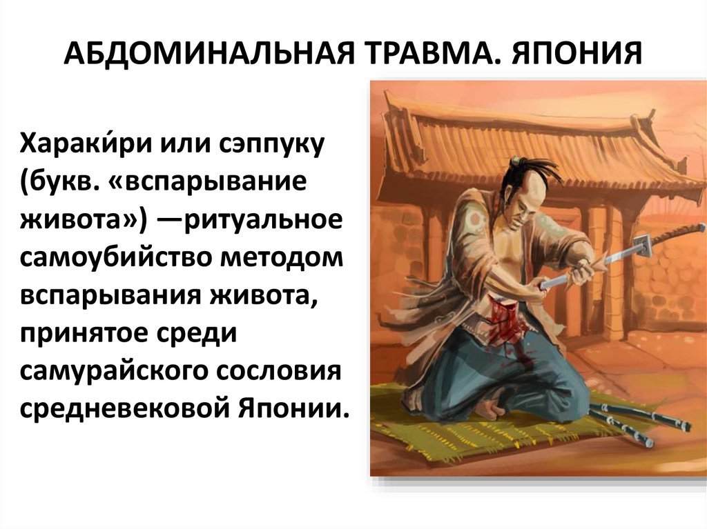 АБДОМИНАЛЬНАЯ ТРАВМА. ЯПОНИЯ