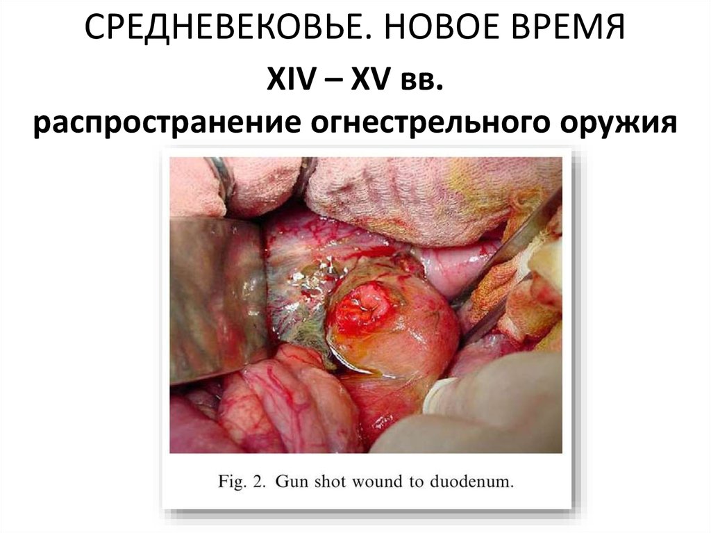 СРЕДНЕВЕКОВЬЕ. НОВОЕ ВРЕМЯ