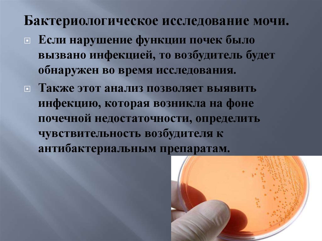 Исследование мочи презентация