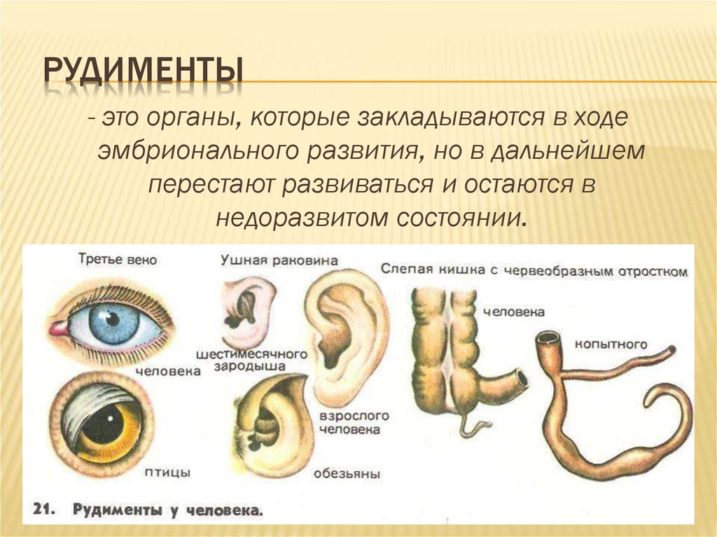 Рудименты человека. Рудименты доказательства эволюции. Рудимент хвост рудимент. Наличие рудиментов и атавизмов. Рудиментами у человека являются.