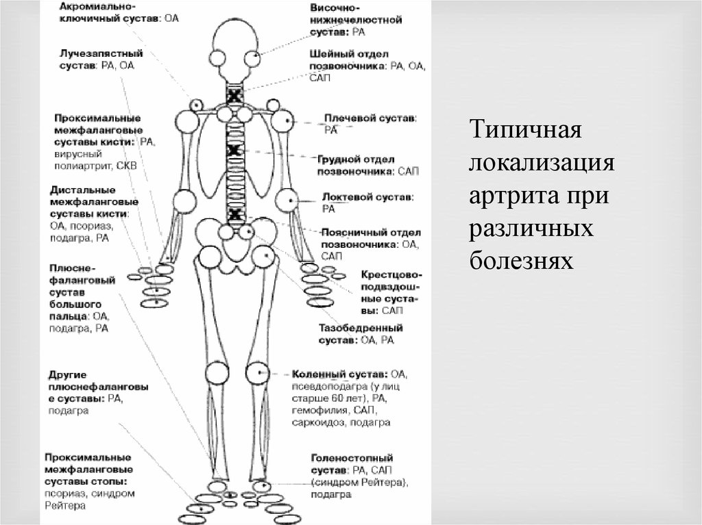 Названия суставов человека. Схема локализации суставов человека. Название суставов. Локализация остеоартроза. Название суставов человека.