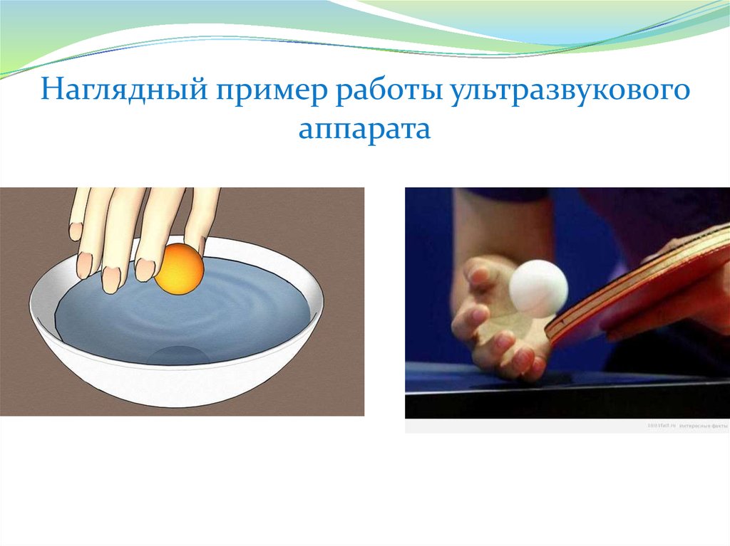 Наглядный пример работы ультразвукового аппарата