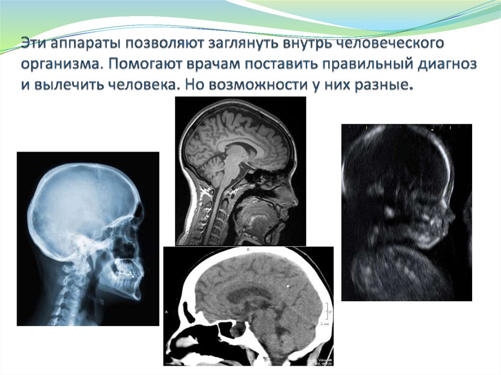 Эти аппараты позволяют заглянуть внутрь человеческого организма. Помогают врачам поставить правильный диагноз и вылечить
