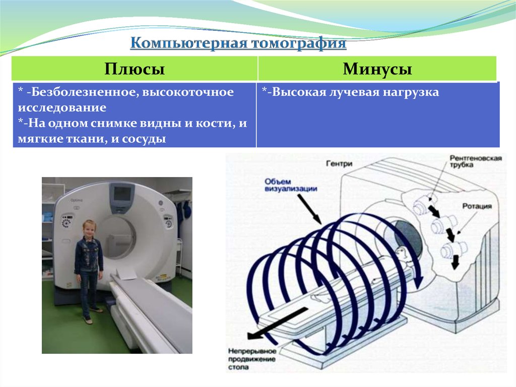 Компьютерная томография