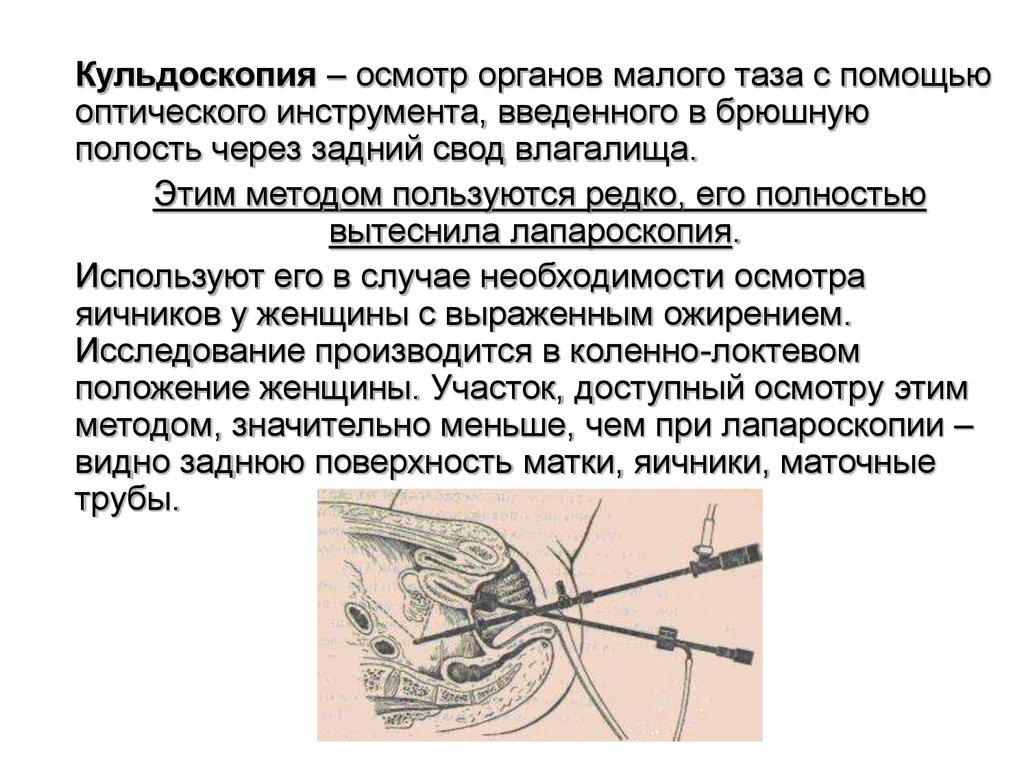 Осмотра органа. Пункция заднего свода показания. Кульдоскопия обезболивание. Пункция заднего свода инструменты. Пункция заднего свода методика.