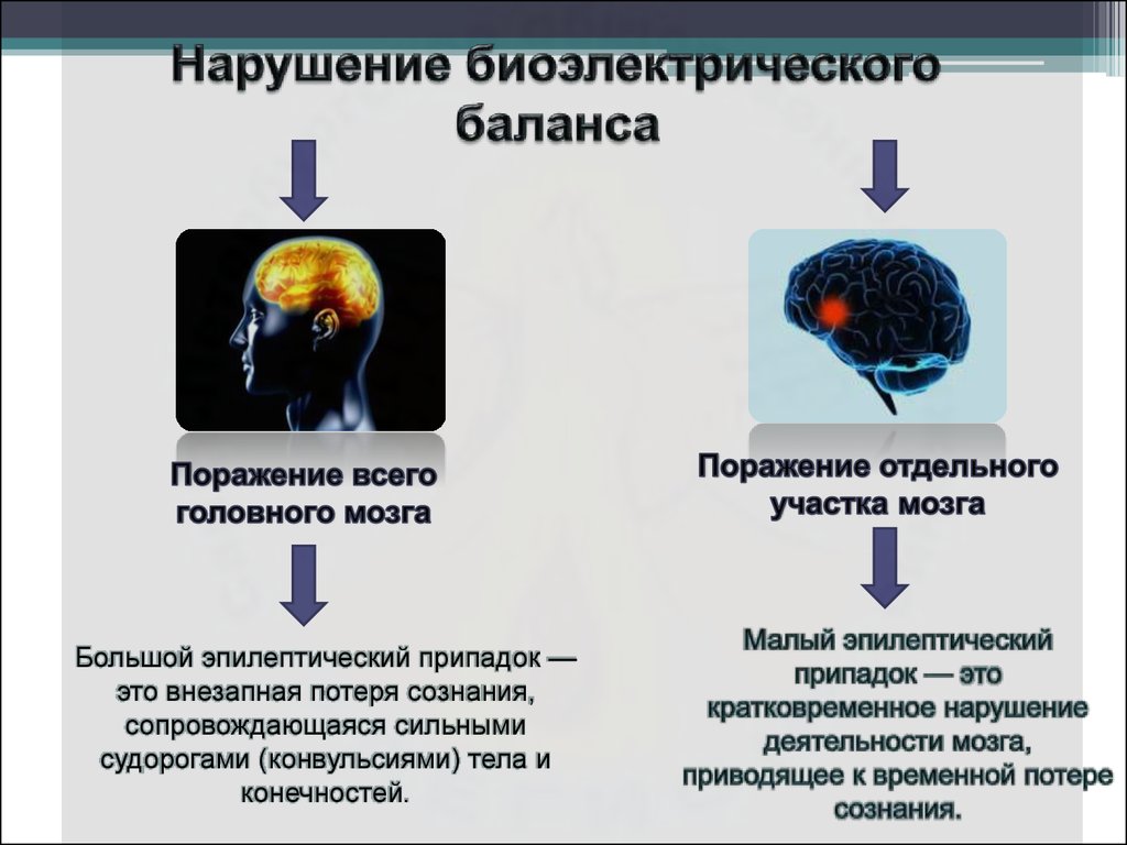 Нарушения биоэлектрической активности. Изменение биоэлектрического потенциала мозга. Биоэлектрическая активность головного мозга функция. Кратковременное отключение мозга. Эпилепсия поражающая весь мозг.