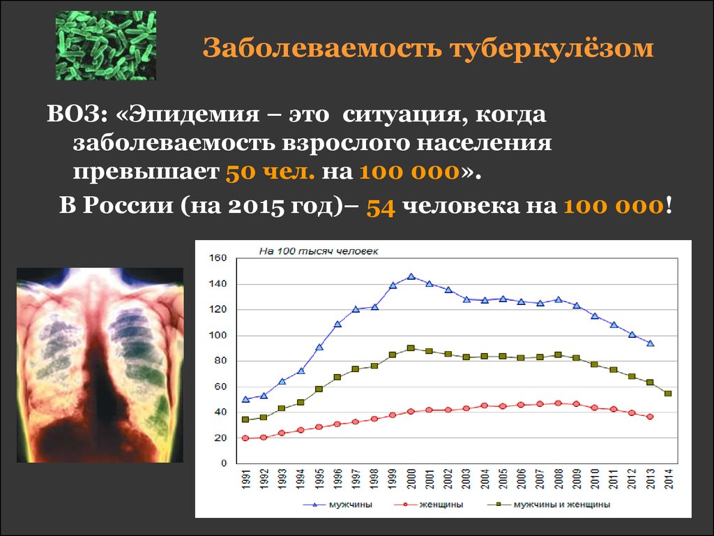 Диаграмма туберкулеза в россии