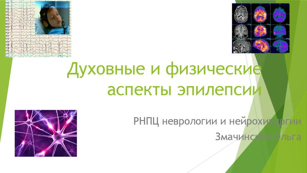 Физические аспекты. Генетические аспекты эпилепсии. Что такое физические аспекты внешности.