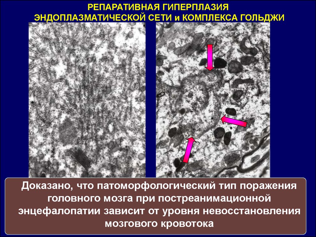 Патоморфологическая картина это