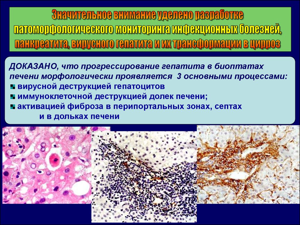 Холера патанатомия презентация