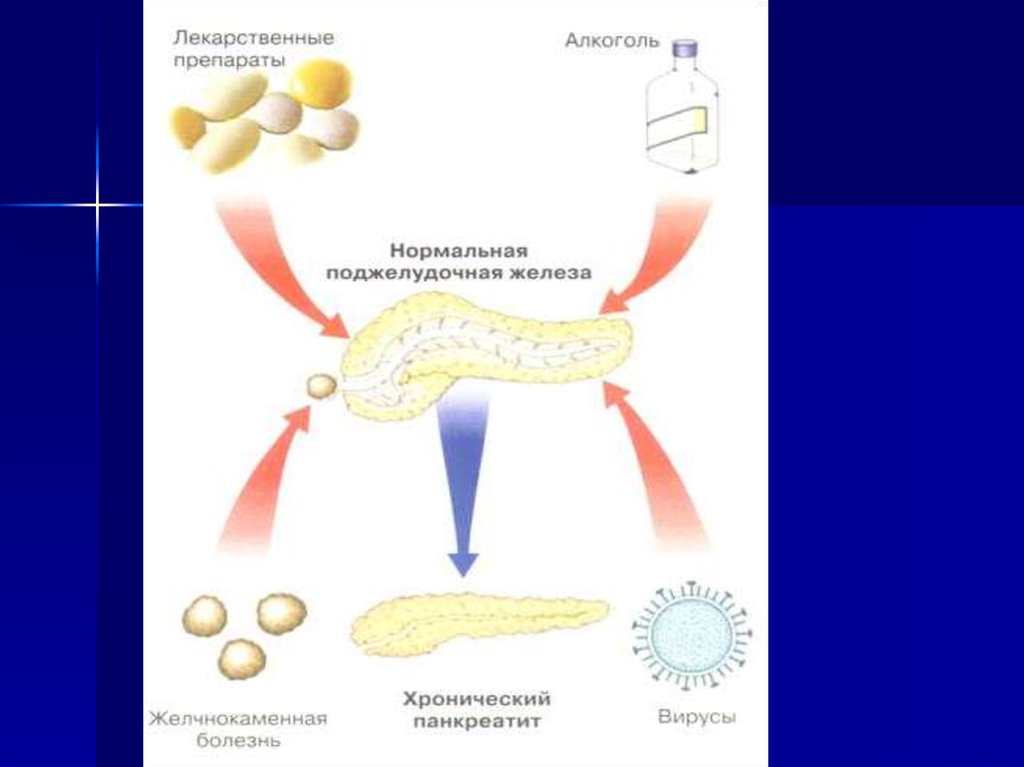 Презентация на тему хронический панкреатит