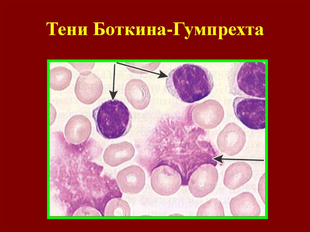 Тени гумпрехта боткина фото