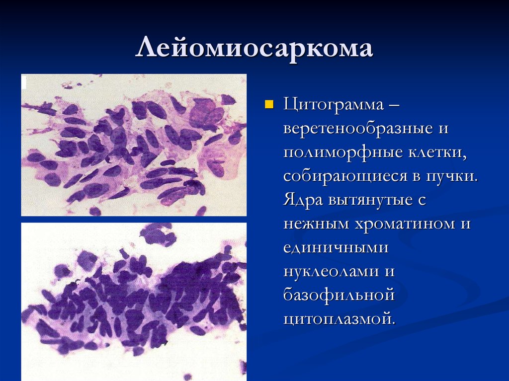 Цитологическая картина воспаления средней степени выраженности