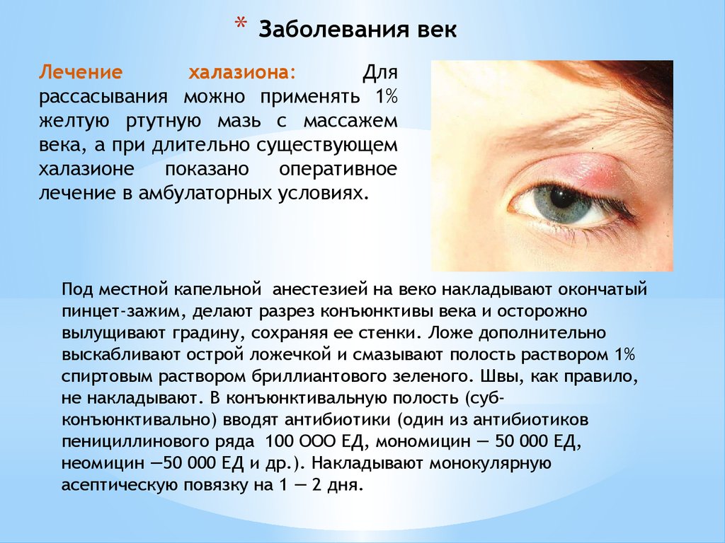 Группы заболеваний глаз. Заболевания век классификация.