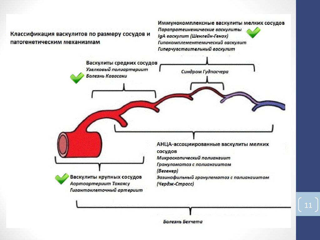 Васкулиты диагностика лечение