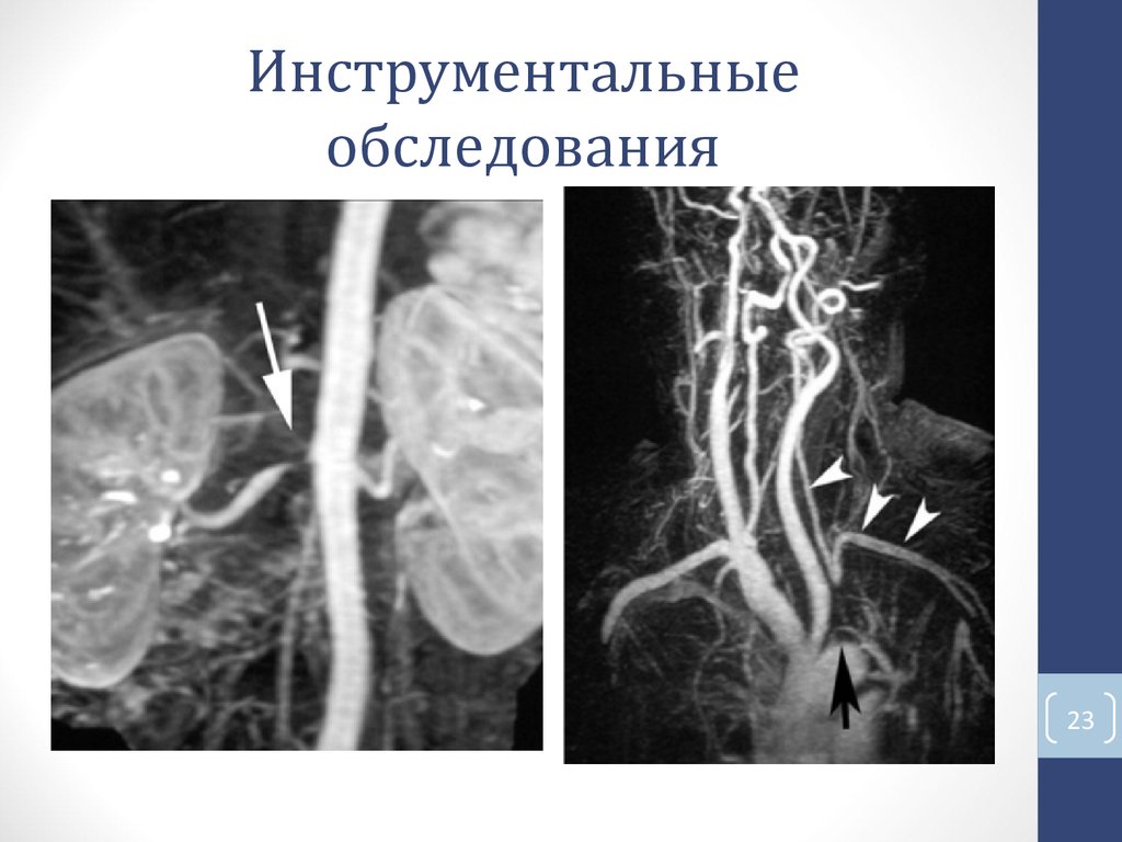 Инструментальные обследования