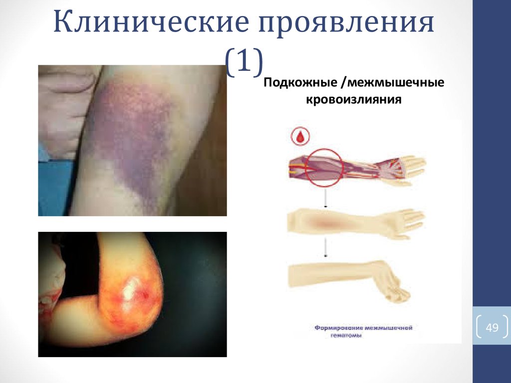 Клинические проявления (1)