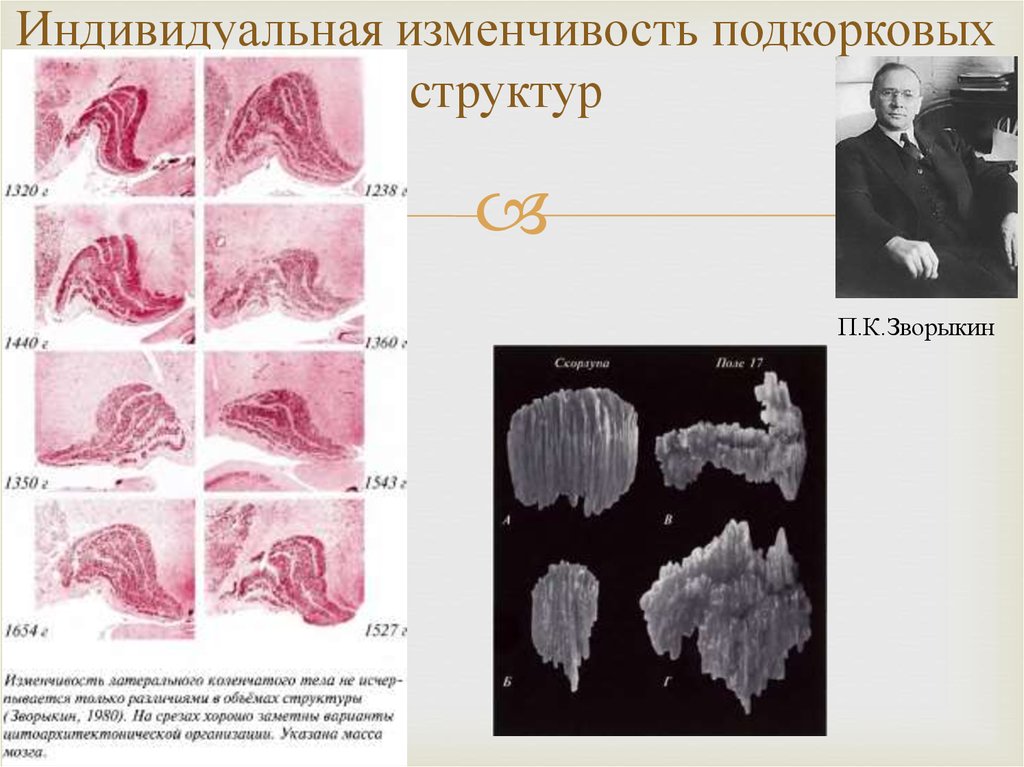 Индивидуальная изменчивость. Индивидуальная изменчивость человека. Всеобщая индивидуальная изменчивость. Примеры индивидуальной изменчивости у человека.