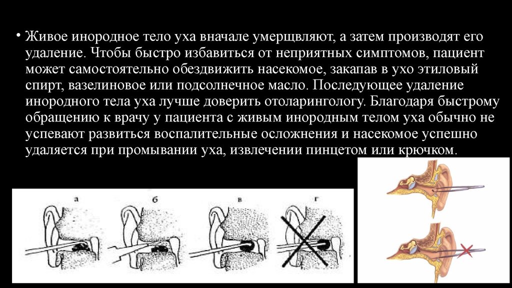 Инородное тело это. Инородные тела уха диагностика. Инороднее тело в простате. Инструмент Шоттера для удаления инородных тел из роговицы.