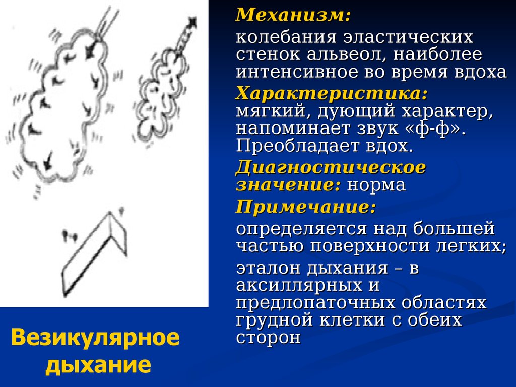 Смешанное дыхание. Нормальное везикулярное дыхание. Механизм образования везикулярного дыхания. Механизм возникновения везикулярного дыхания. Везикулярное дыхание Графическое изображение.