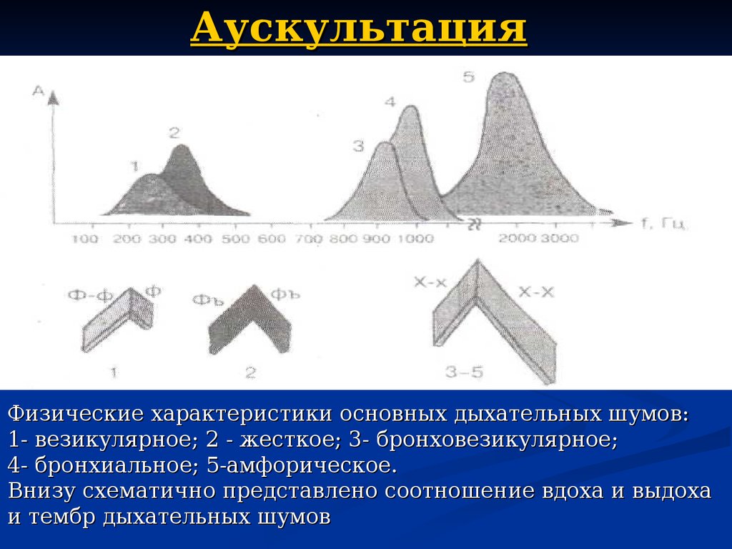 Схемы основных дыхательных шумов