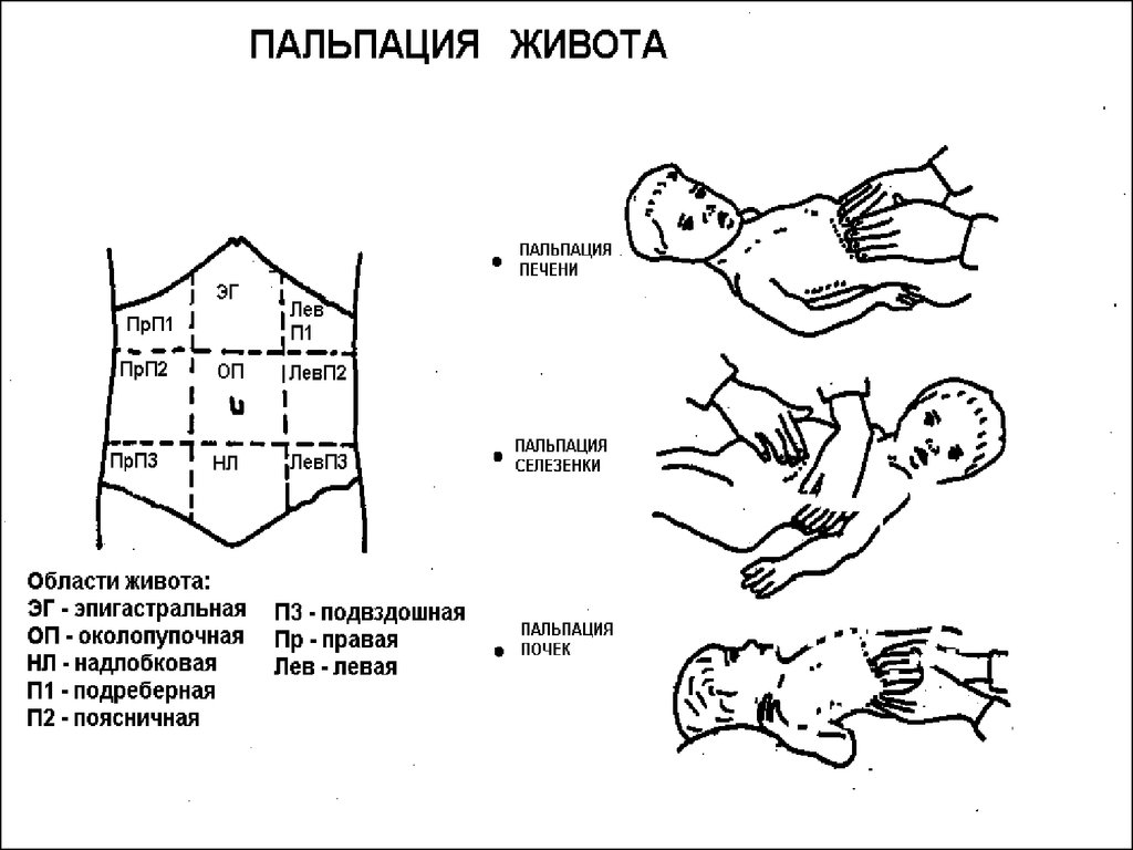 Увеличена печень у новорожденного. Методика поверхностной пальпации живота у детей. Поверхностная пальпация живота схема. Пальпация печени у новорожденных в норме. Поверхностная пальпация живота у детей.