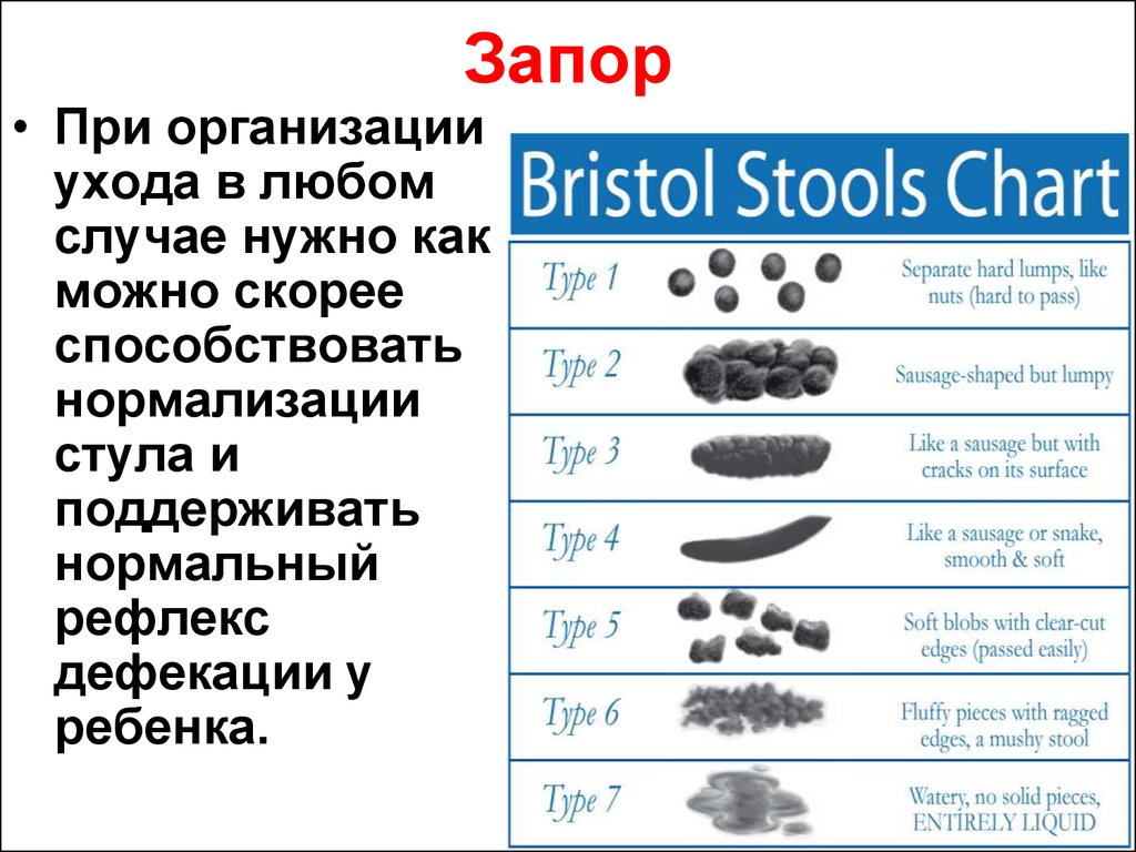 Стул запор