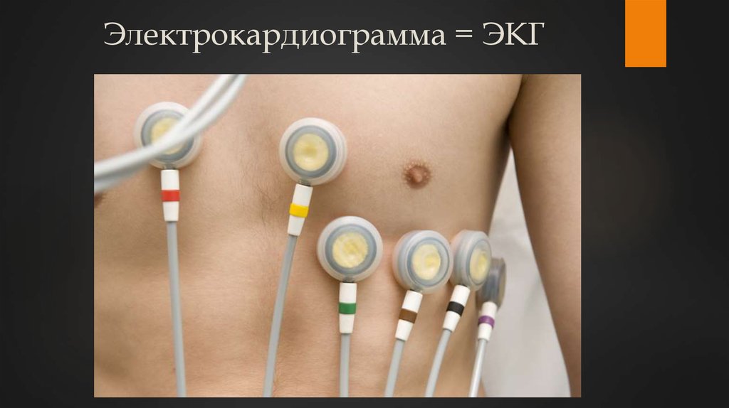 Электрокардиограмма = ЭКГ