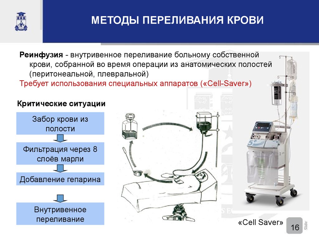 Современные методы операций. Методы переливания крови реинфузия. Система для внутривенного переливания крови схема. Cell Saver аппарат. Аппарат интраоперационной реинфузии аутологичной крови.