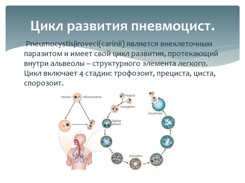 Доклад по теме Пневмоцистоз