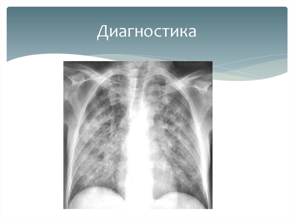 Диагностика