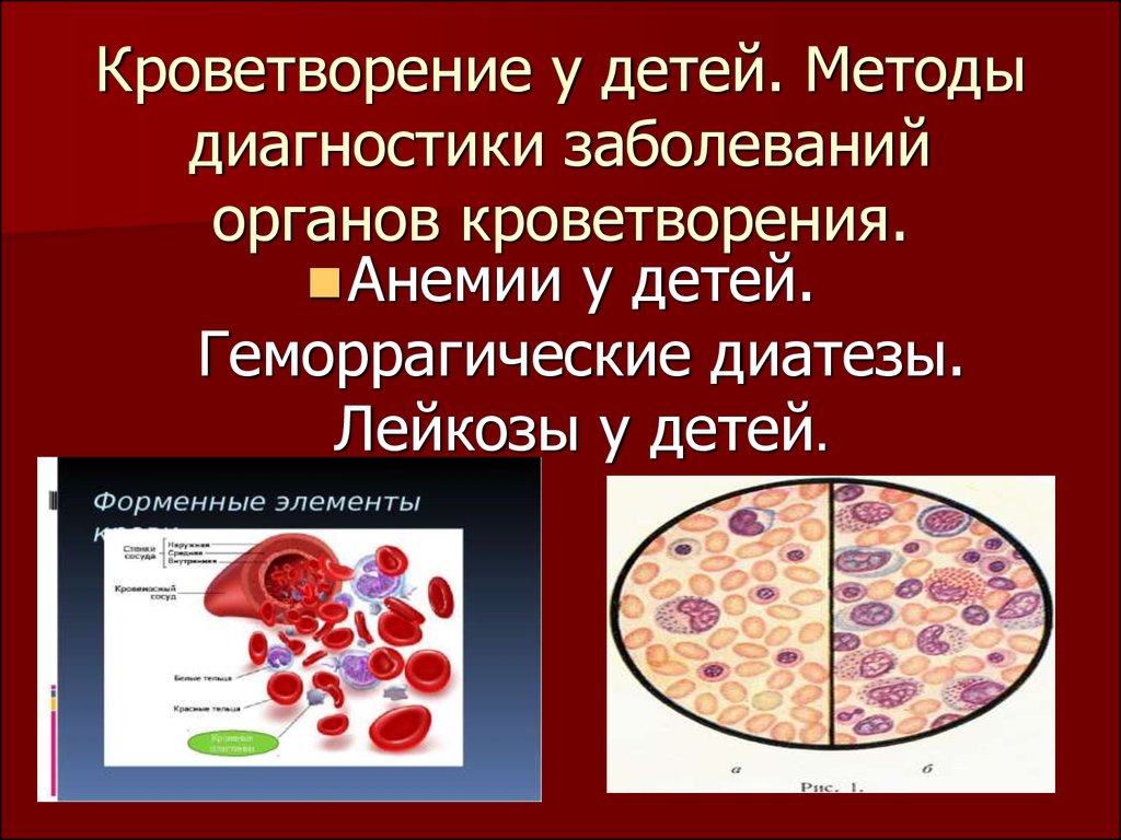 Поражения системы крови
