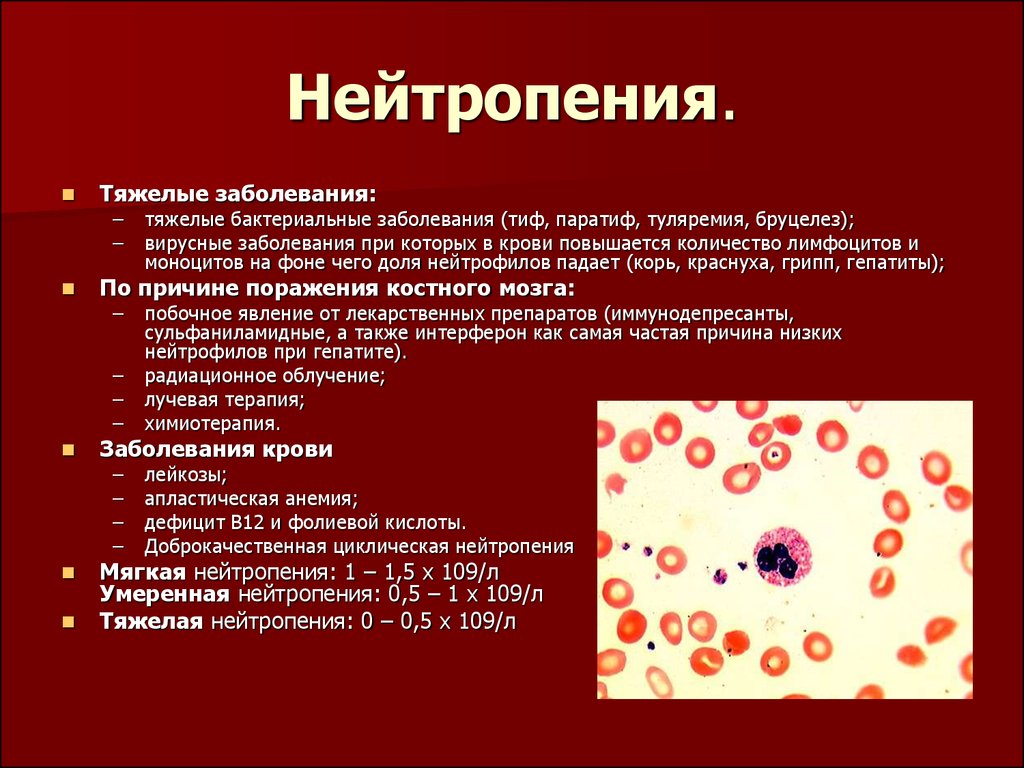 Лейкоцитоз причины у женщин. Сегментоядерные нейтропения. Нейтропения характерна для. Нейтропения картина крови. Снижение сегментоядерных нейтрофилов в крови.
