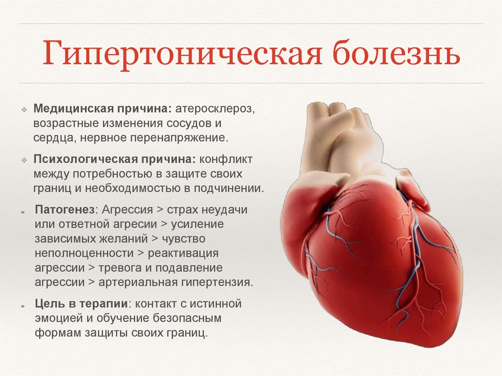 Гипертония стоп презентация