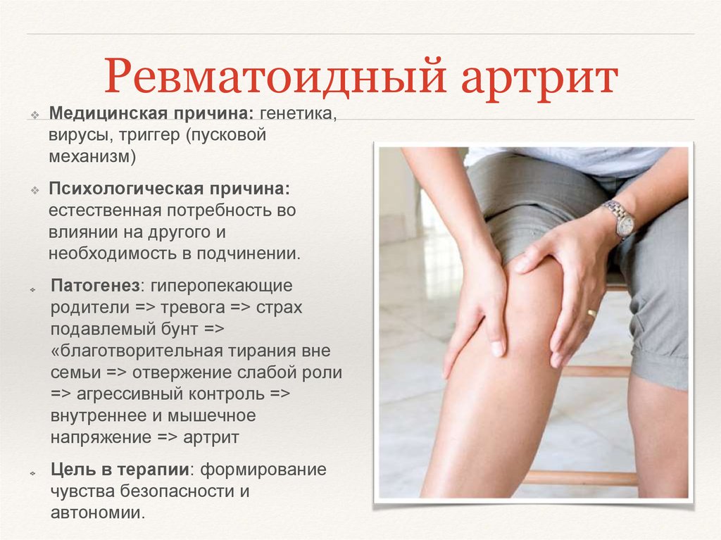 Ревматоидный артрит