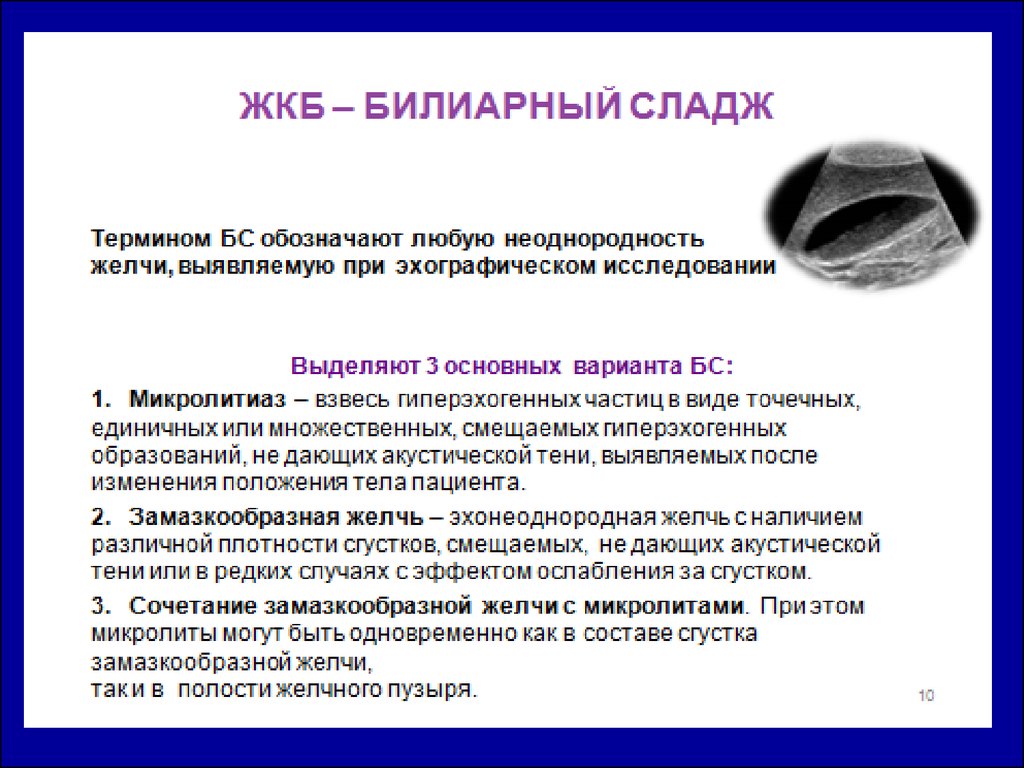 Сладж желчного пузыря. Клинические проявления сладж синдрома. Сладж-синдром желчного пузыря на УЗИ. Сладж феномен желчного пузыря. Билиарный сладж в желчном пузыре.