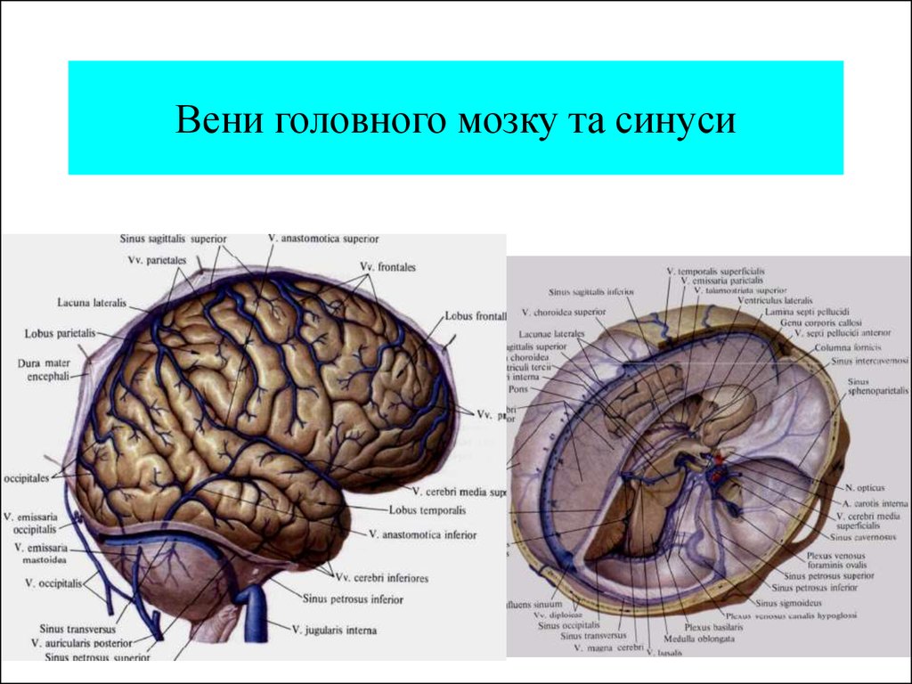 Вены головного мозга