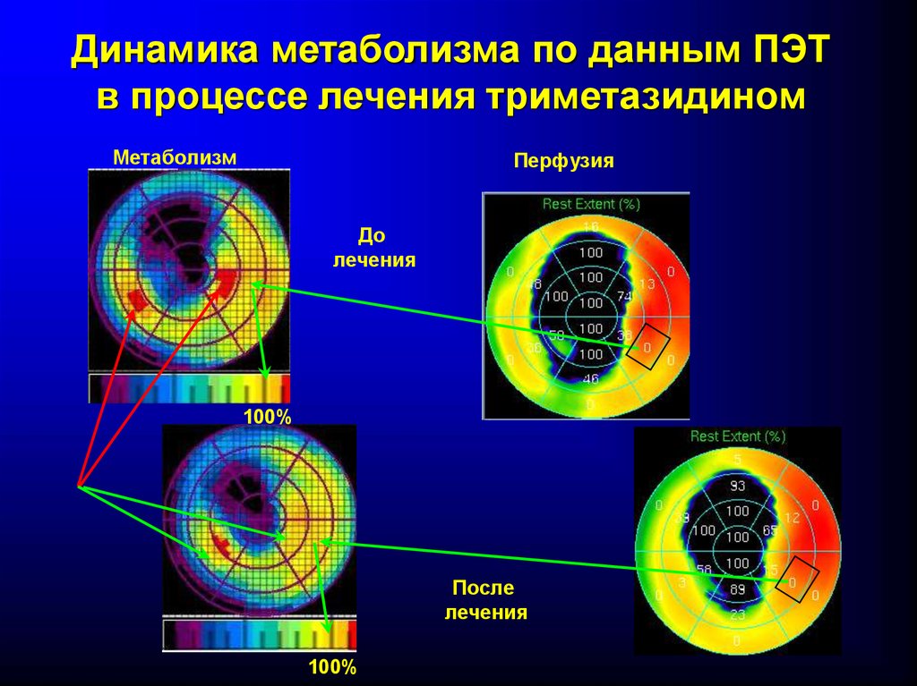 Данные пэт. Динамика белкового обмена. Оценка эффекта по данным ПЭТ.