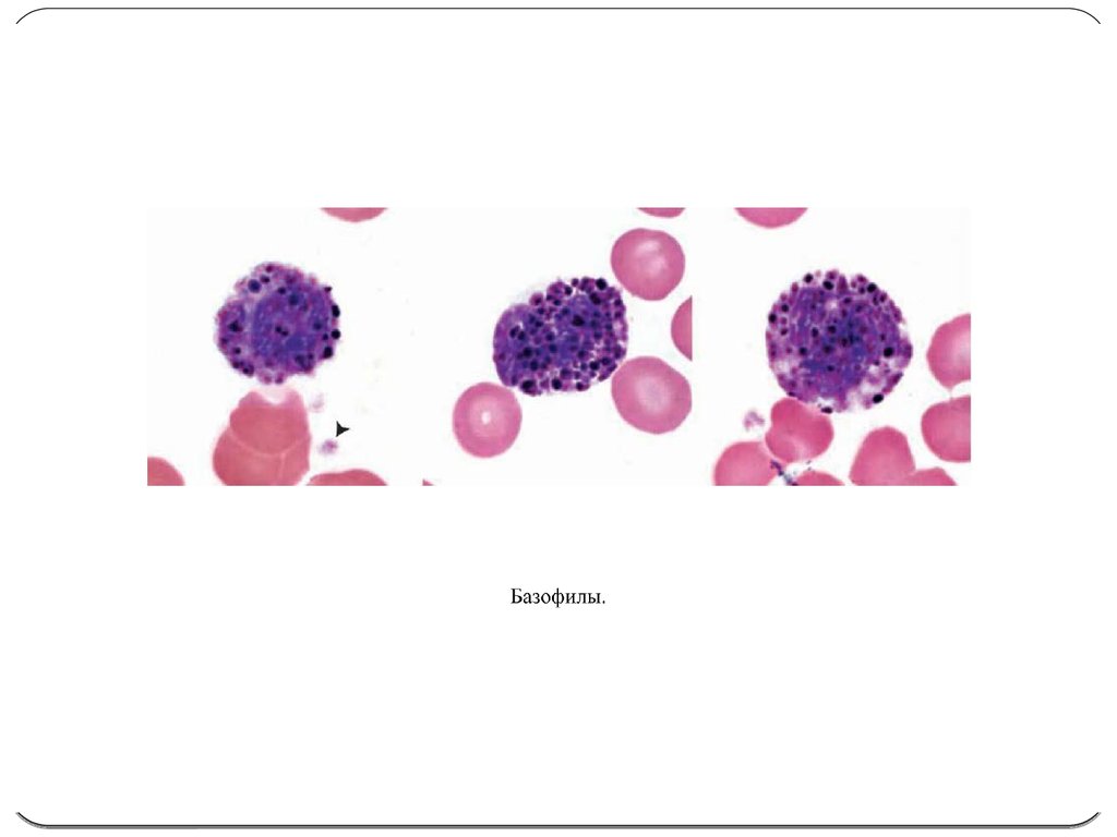 Базофилы это. Лейкоцитарная формула базофилы. Базофил в мазке. Морфологические особенности базофилов. Базофилы (ba).