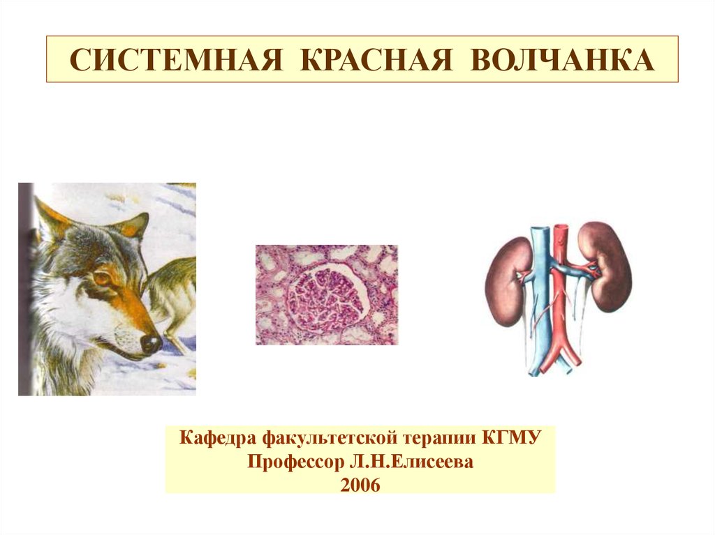 Системная красная волчанка лечение презентация