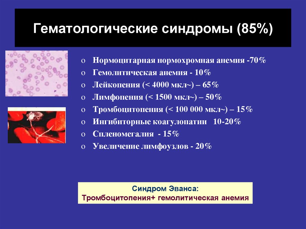 Системная анемия. Анемия при системной красной волчанке. Гематологический синдром. Гематопоэический синдом. Гемолитическая анемия при СКВ.