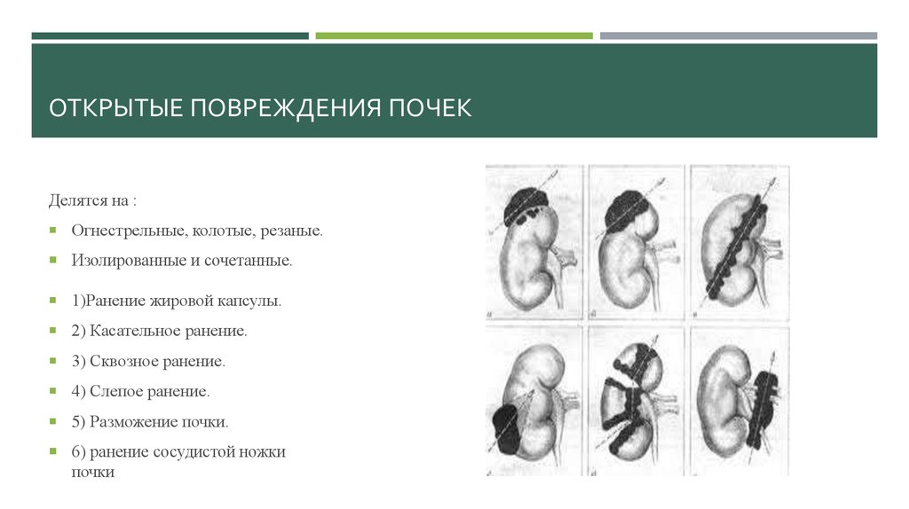 Схема обработки почек