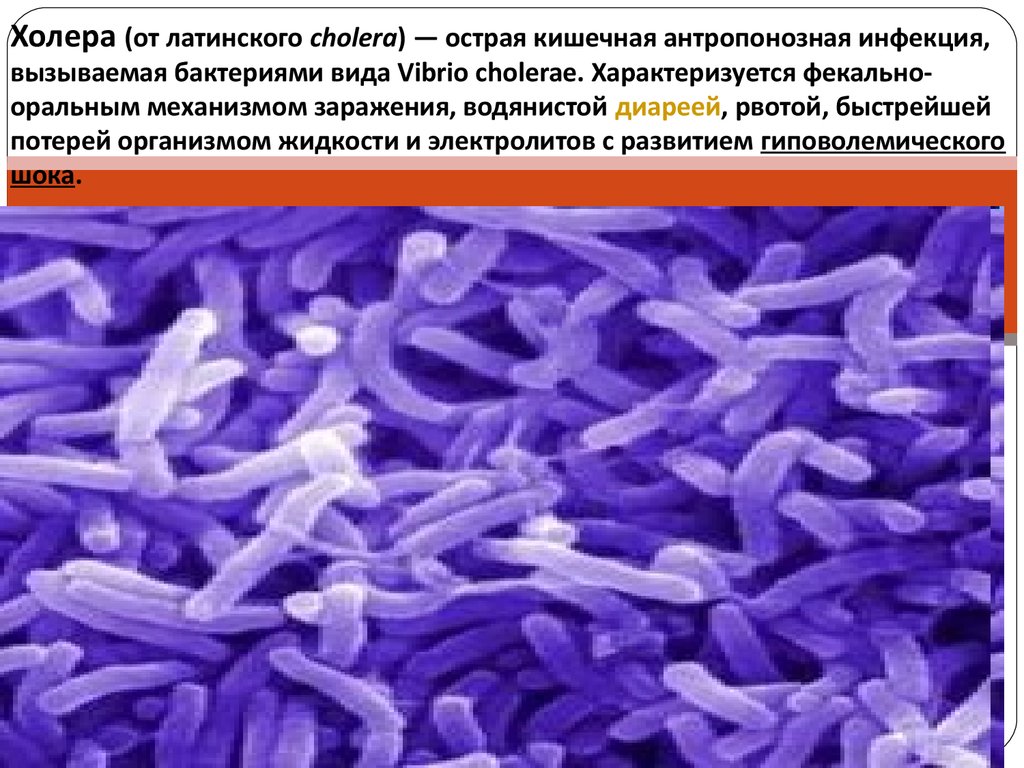 Холера имеет. Холерный вибрион это бактерия. Болезнетворные бактерии холерный вибрион. Презентация на тему холера. Холерные вибрионы вызывают заболевания.