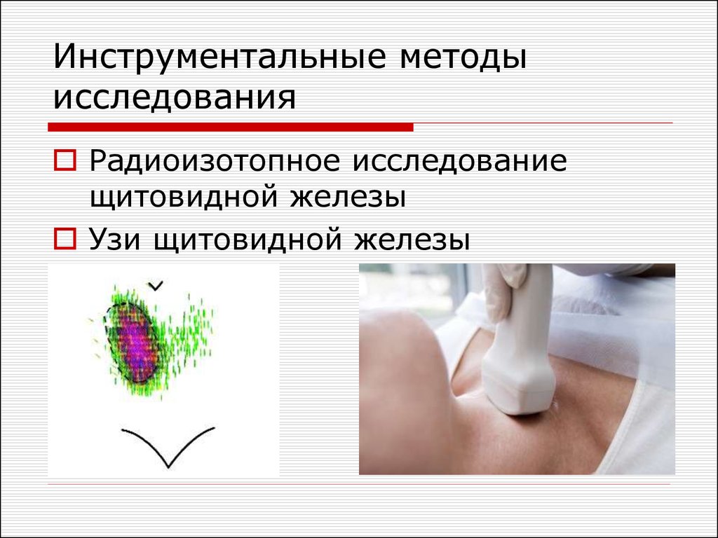 Исследование железы. Лабораторные методы исследования при заболеваниях ЩЖ. Алгоритм исследования при заболевании щитовидной железы. Инструментальное исследование при заболевании щитовидной железы. Инструментальные методы исследования щитовидной железы.