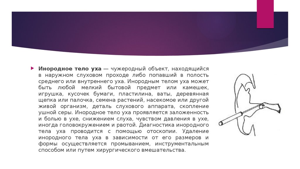 Удаление инородного. Методы удаления инородного тела из наружного слухового прохода. Инородные тела уха (наружного слухового прохода). Удаление инородного тела уха. Инородное тело уха удаляется.