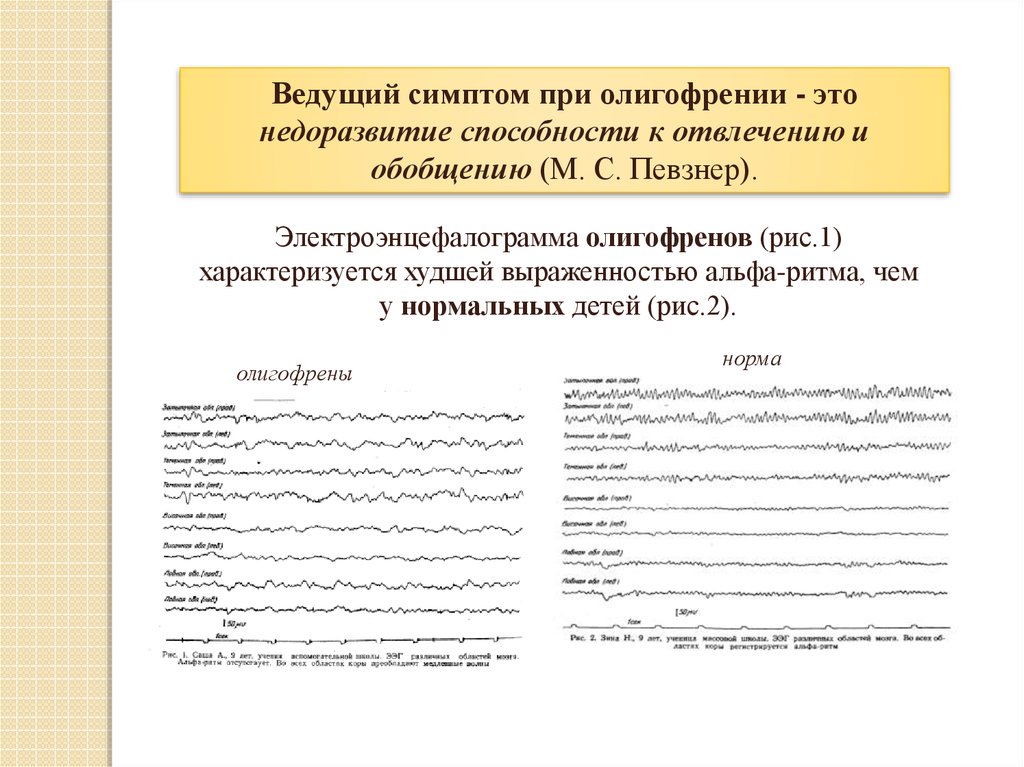 На первый план при олигофрении выступают нарушения развития