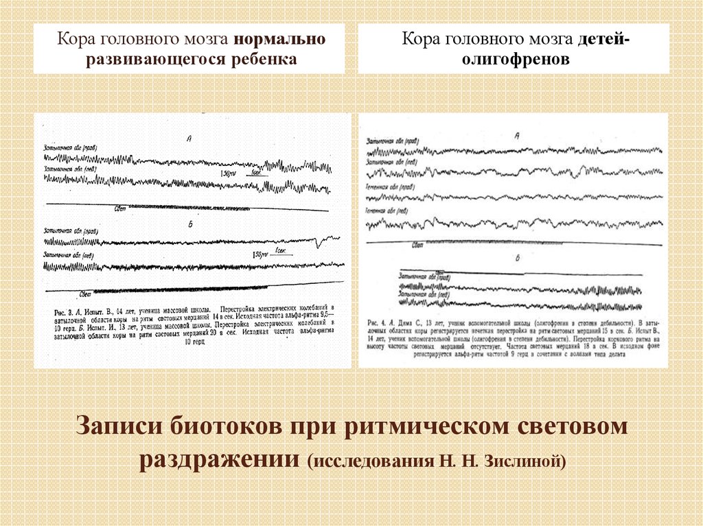 Записи биотоков при ритмическом световом раздражении (исследования Н. Н. Зислиной)