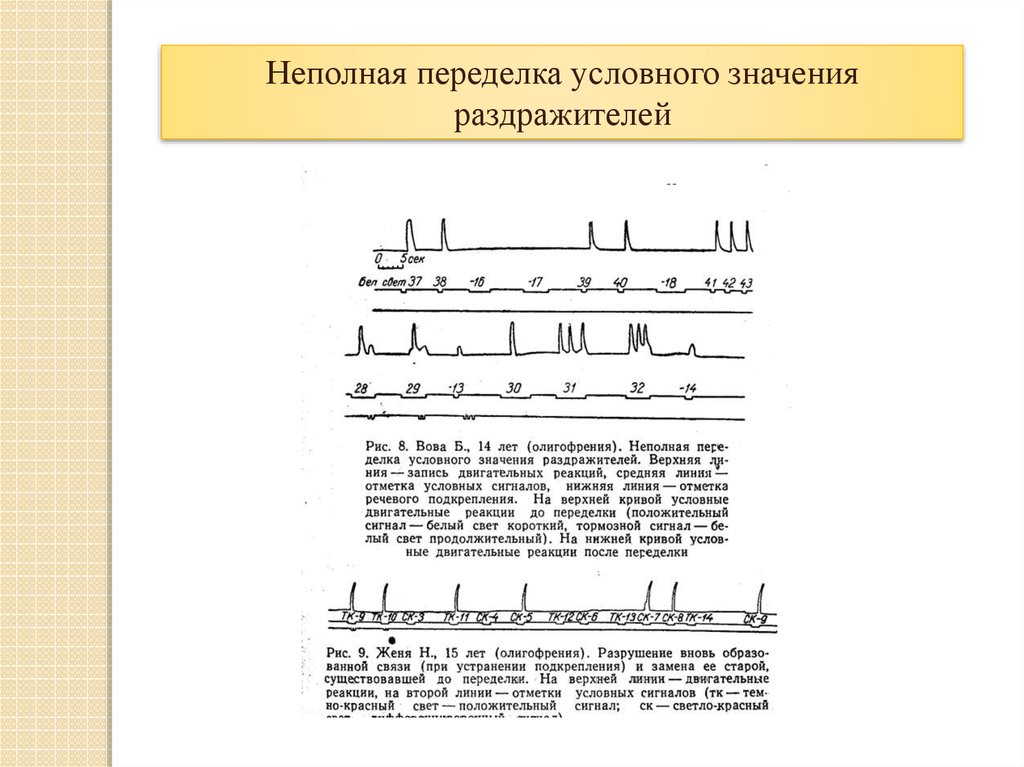 Условно значимый. Что значит условно положительный. Динамика олигофрении (положительная, отрицательная). Год условно что значит. Что значит подкрепление условного раздражителя.