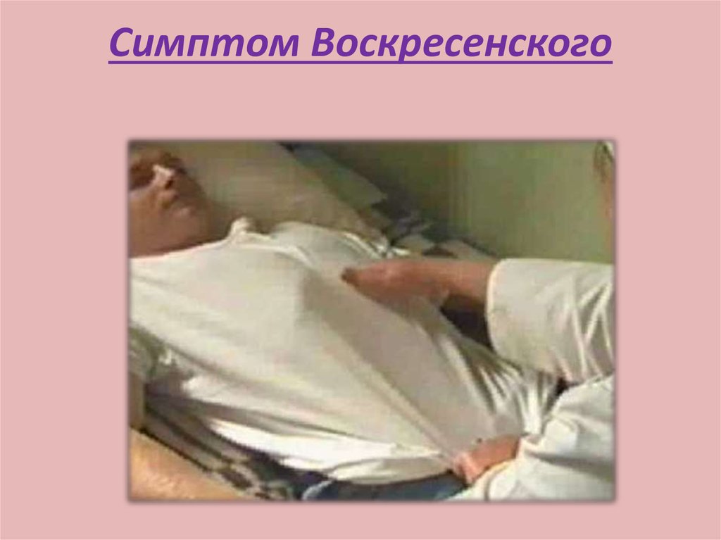 Симптом Воскресенского