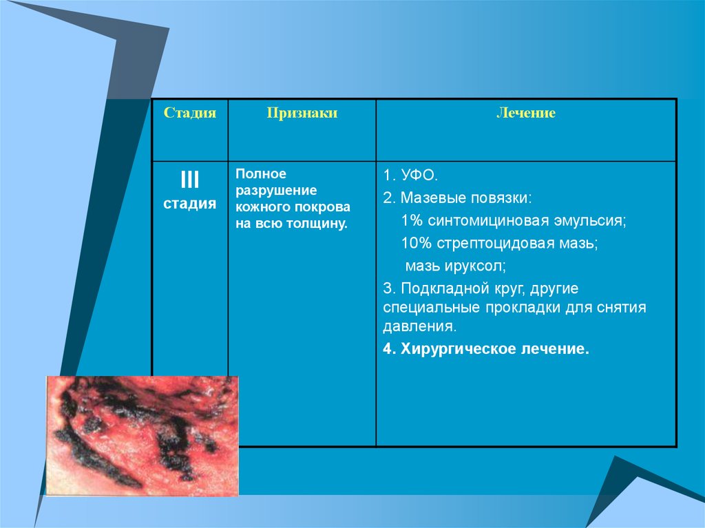 Признаки полной. Разрушение кожного Покрова. Стадии кожной реакции пациента на УФО. Стадии разрушения кожи.